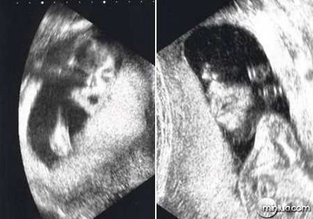 a97768_jackson-ultrasound