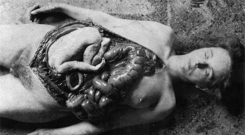 a-vivisection-of-the-pregnant-womanat-the-unit-731-this-pregnant-young-woman-was-infected-with-syphilis-for-to-study-the-efficiency-of-the-new-japanese-antibiotic-terramycin-on-the-infe