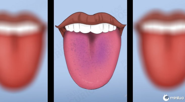 sintomas língua cor violeta