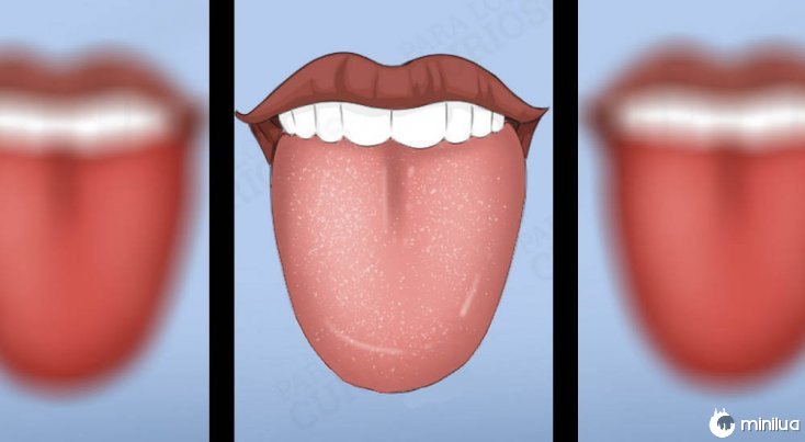 Os sintomas pálido colorido língua