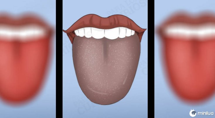 sintomas língua cor cinza
