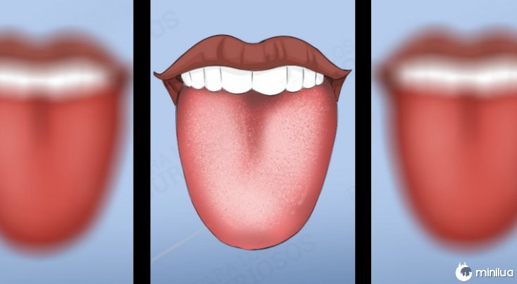 sintomas cor da camada branca língua