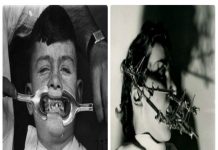15 imagens antigas e assustadoras que vão fazer você nunca mais ir ao dentista
