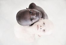 Essas fotos deslumbrantes mostram a beleza das crianças albinas para aumentar a consciência de sua situação desonesta na Tanzânia