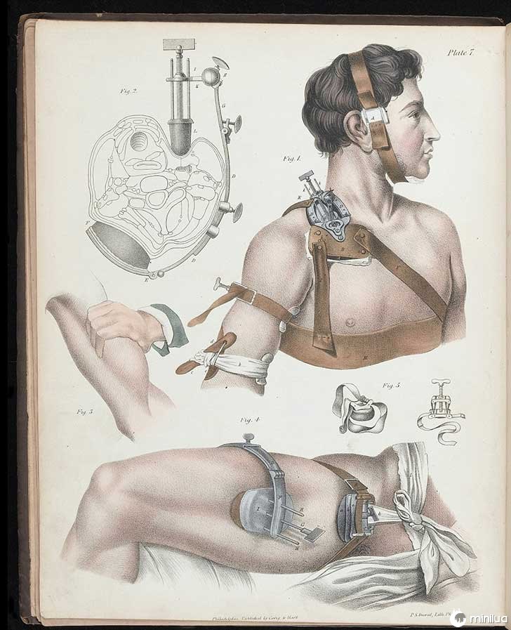século barbara cirurgia 19 11
