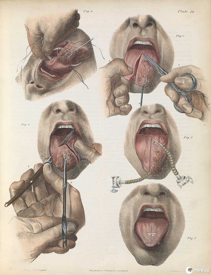 século barbara cirurgia 19 2