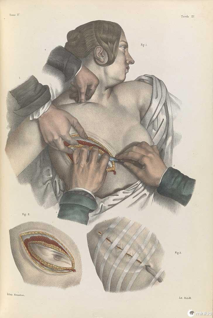 século barbara cirurgia 19 5