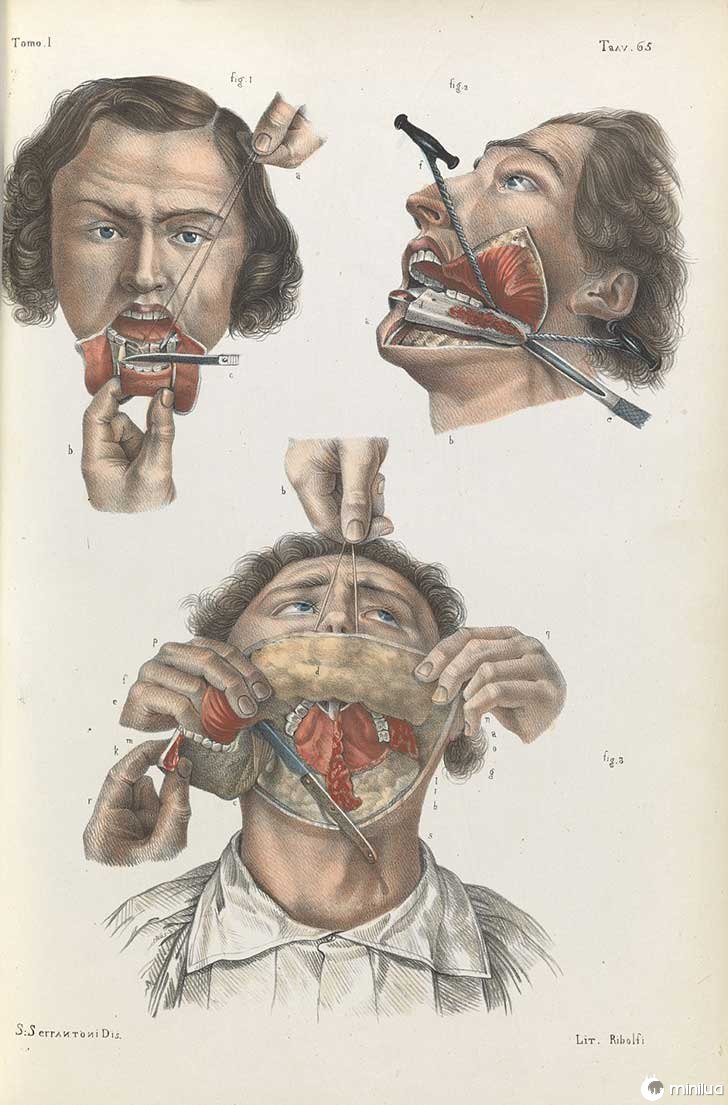 século barbara cirurgia 19 6