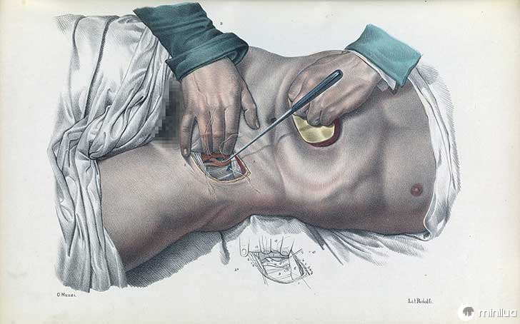 século barbara cirurgia 19 7