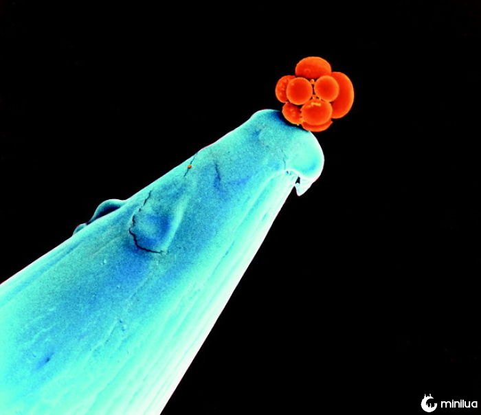 Um embrião humano precoce na ponta de uma agulha