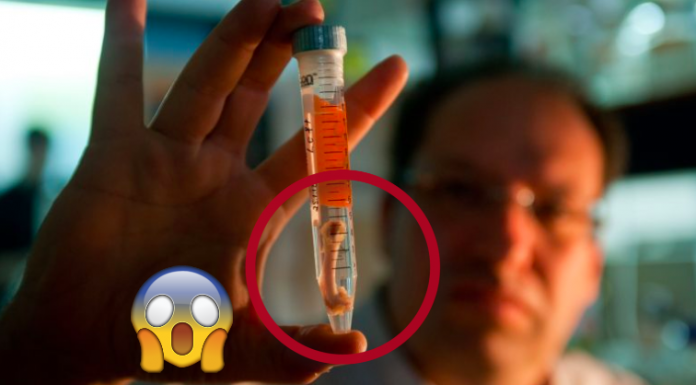 Inovador! Empresa transforma sua gordura em enxertos ósseos vivos