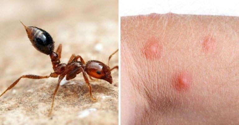 Como reconhecer todas as 12 picadas de insetos mais comuns - Minilua