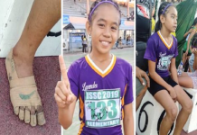 Garota cria seu próprio tênis Nike com ataduras e ganha três medalhas de ouro no atletismo