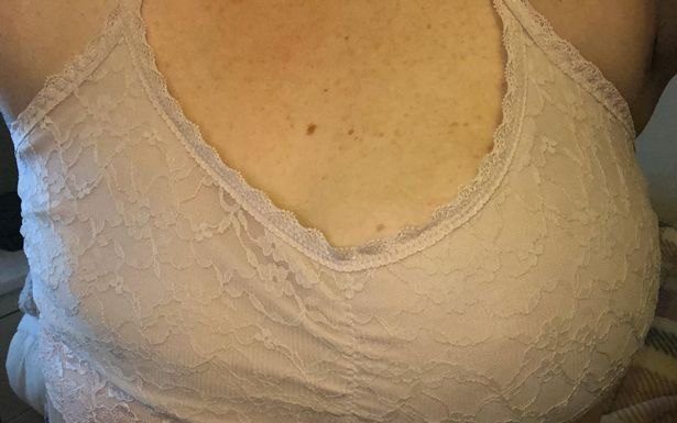 Aplique de cabelo salva mulher de 25 anos do câncer de mama
