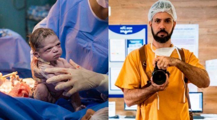 Bebê recém-nascido faz rosto épico na foto do nascimento viral