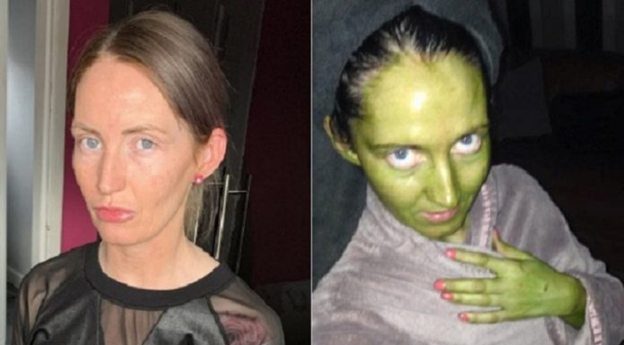 Mãe fica verde claro depois de usar bronzeado fora da validade