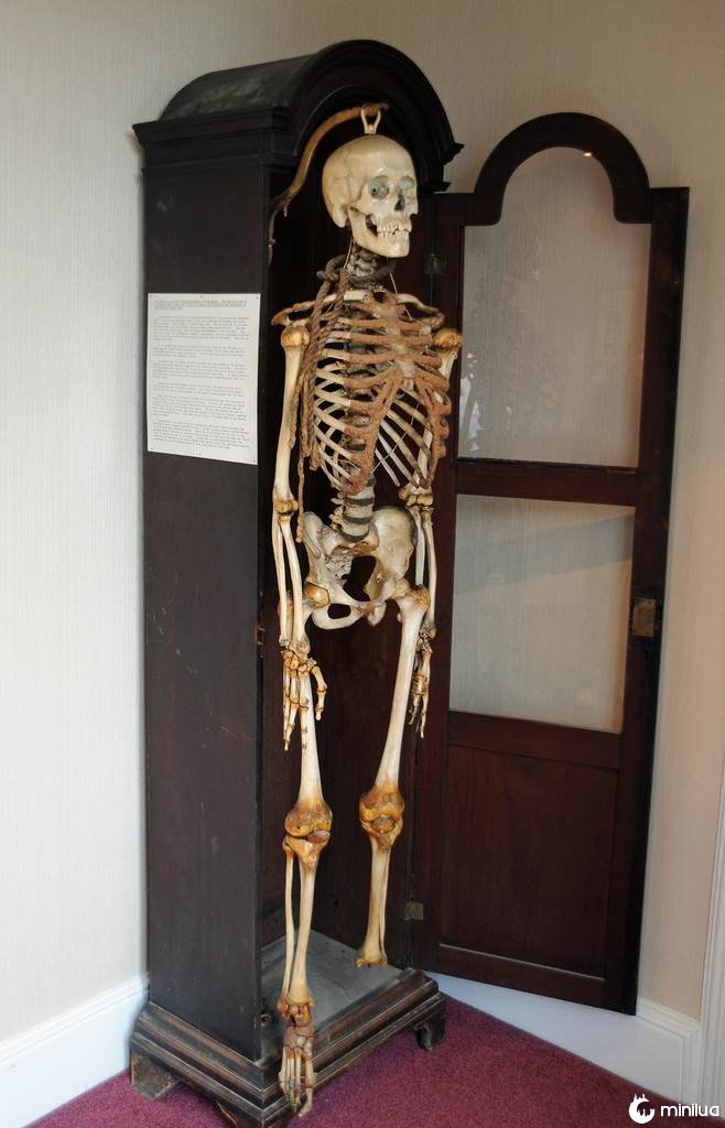 John Horwood's skeleton 