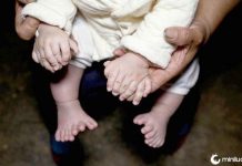 Bebê Nascido com Trinta e Um Dedos no total