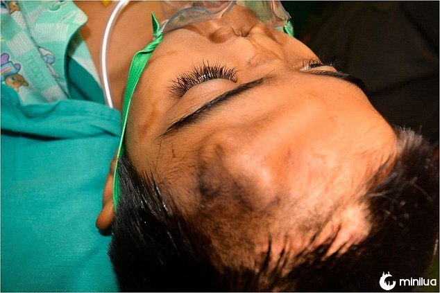 arun patel nose surgery grown forehead