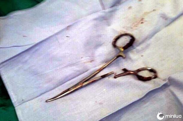 Vietnam 18 year scissors inside stomach surgery ma van nhat