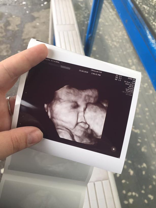 A scan at 34 weeks revealed Maya had an impressive barnet