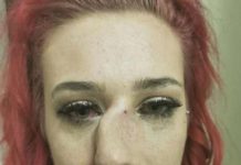 Modelo de concurso de beleza fala de horror depois de receber um soco de um estranho