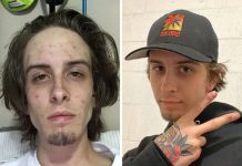 Ex-viciado em drogas compartilha fotos de antes e depois de sua recuperação notável