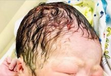 Bebê recém-nascido segura O DIU da mãe que não conseguiu impedir a gravidez