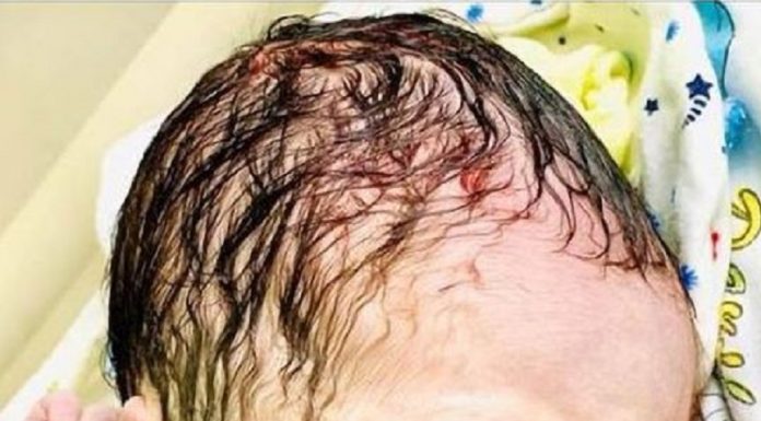 Bebê recém-nascido segura O DIU da mãe que não conseguiu impedir a gravidez