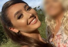 Mulher sofre mutação nos lábios, após preenchimento dar terrivelmente errado