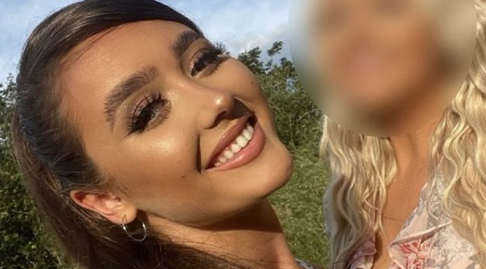 Mulher sofre mutação nos lábios, após preenchimento dar terrivelmente errado