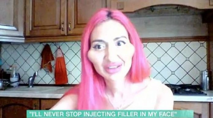 Fã de preenchimento facial diz que está conquistando corações atraídos por ela