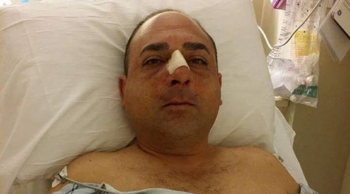 Homem sóbrio descobre que tem uma "cervejaria na barriga" após ser preso por dirigir embriagado