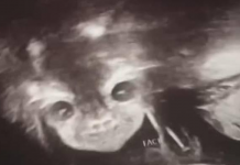 Grávida fica chocada quando a ultra revelou um bebê demoníaco olha para ela