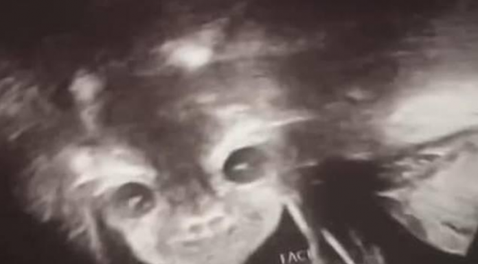 Grávida fica chocada quando a ultra revelou um bebê demoníaco olha para ela