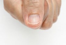 Veja alguns problemas de saúde que suas unhas podem indicar