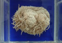 Ameba comedora de cérebro é encontrada em água que abastece cidades do Texas Ameba “comedora de cérebro”