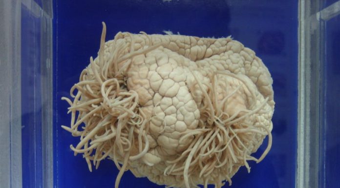 Ameba comedora de cérebro é encontrada em água que abastece cidades do Texas Ameba “comedora de cérebro”