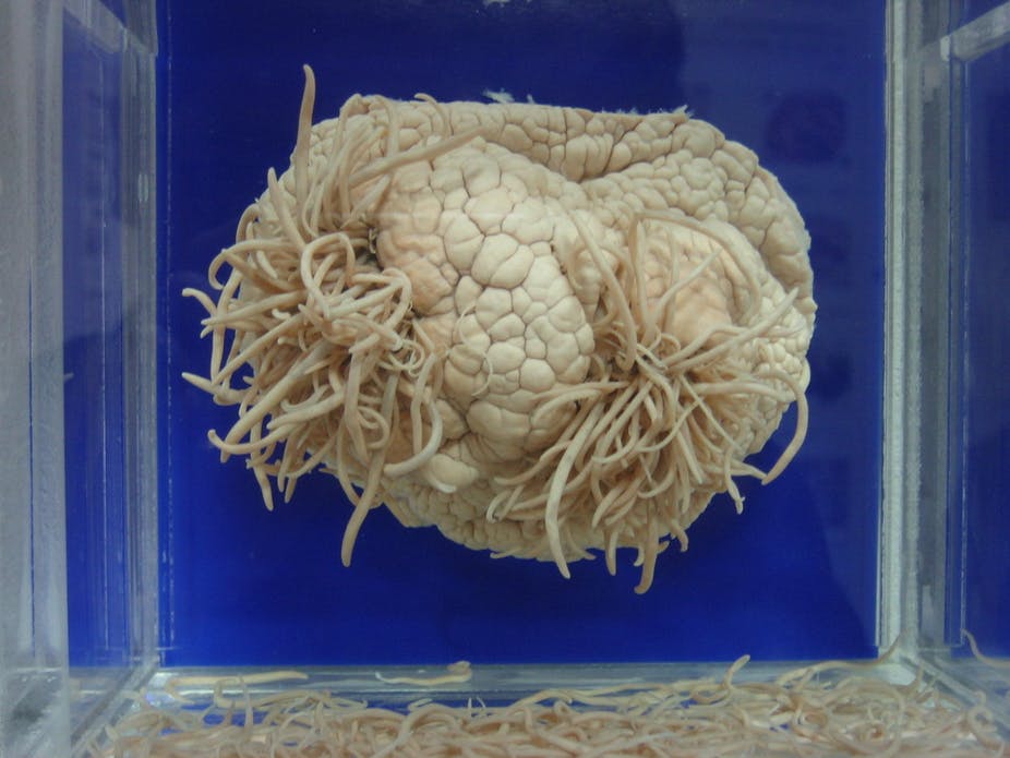 Ameba “comedora de cérebro”