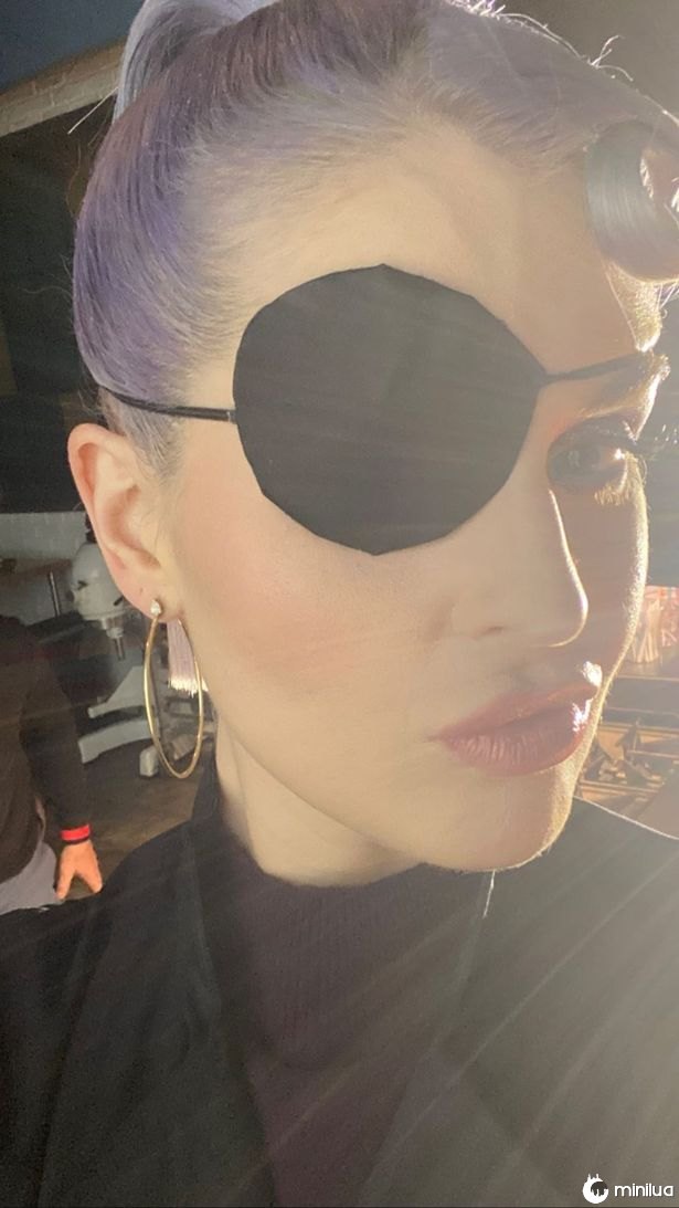 Kelly Osbourne foi forçada a usar tapa-olho após desastre de maquiagem