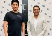 Homem submetido a cirurgia de alongamento de membros para crescer de 1,80 metros para 1,85 metros